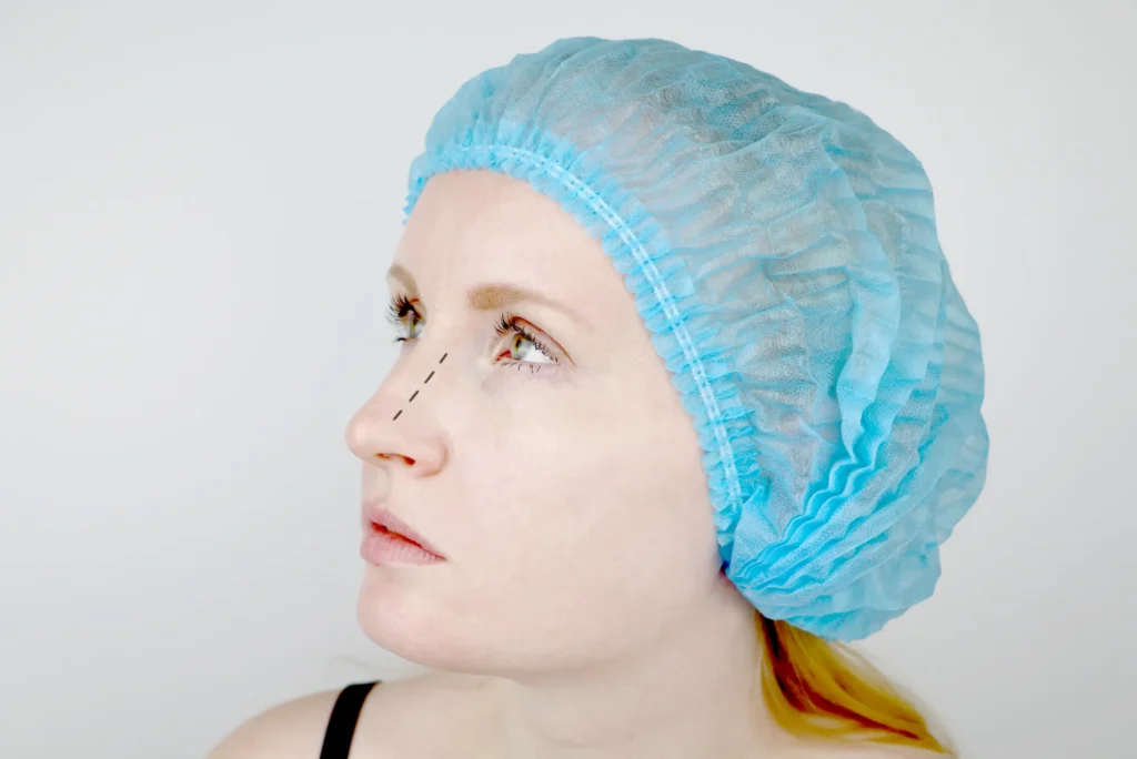 What’s the Real Rhinoplasty Turkey Price or Cost?